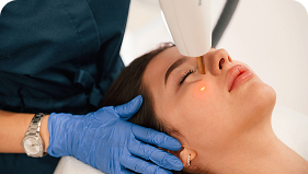 Tratamento a laser